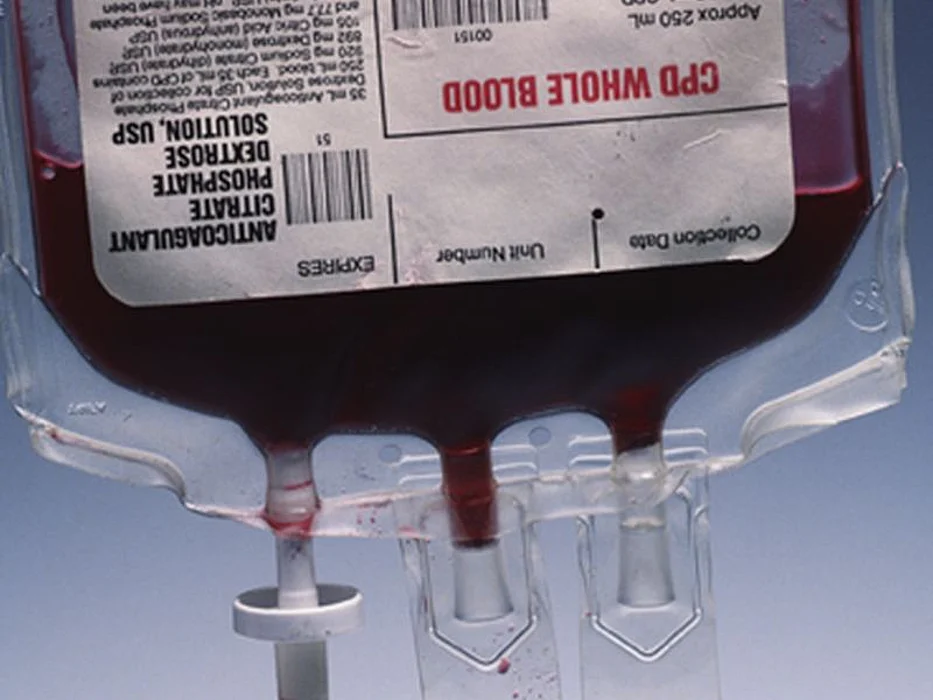 blood sample