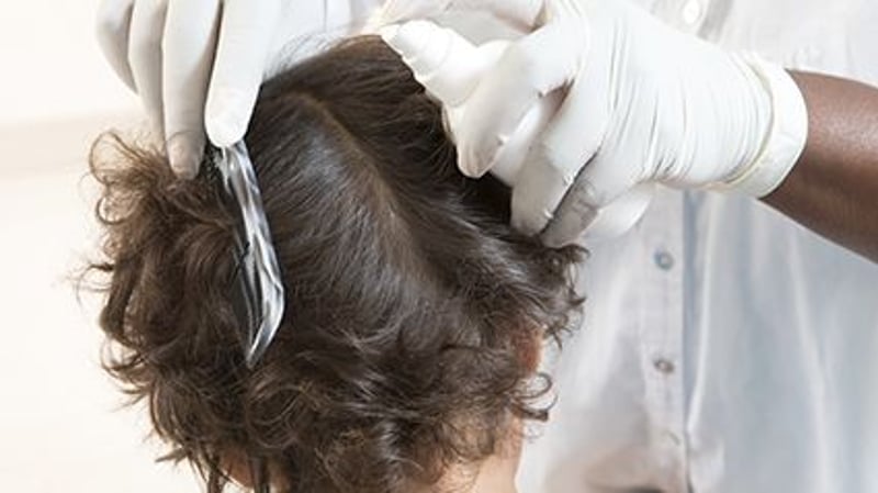 News Picture: Pediatricians Offer Latest Advice on Controlling Head Lice in Kids