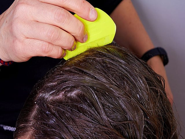 Topical Treatment for Head Lice Approved for OTC Use Consumer Health