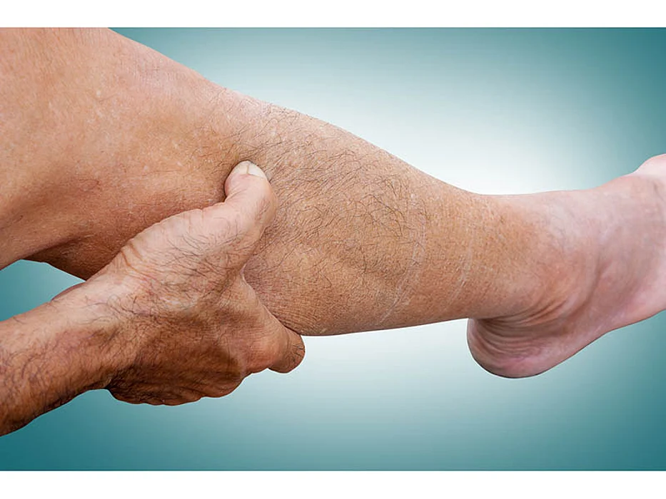 leg cramp