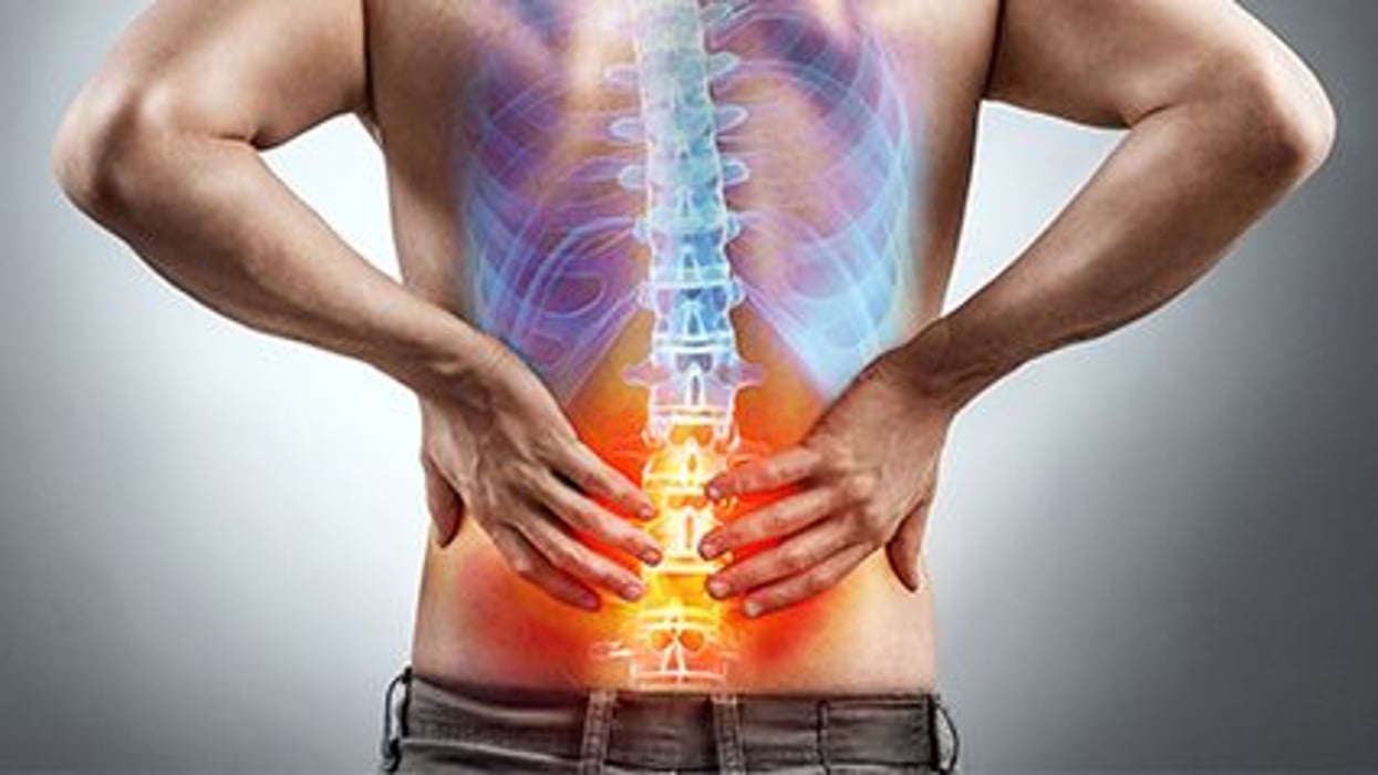 back pain picture