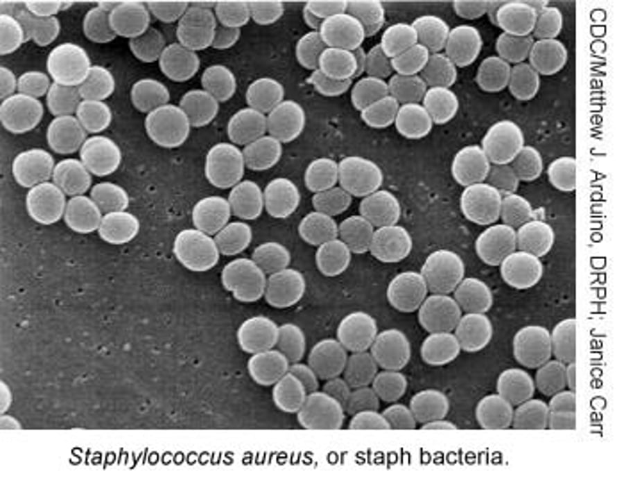 Special Report: Drug-Resistant Staph Infections