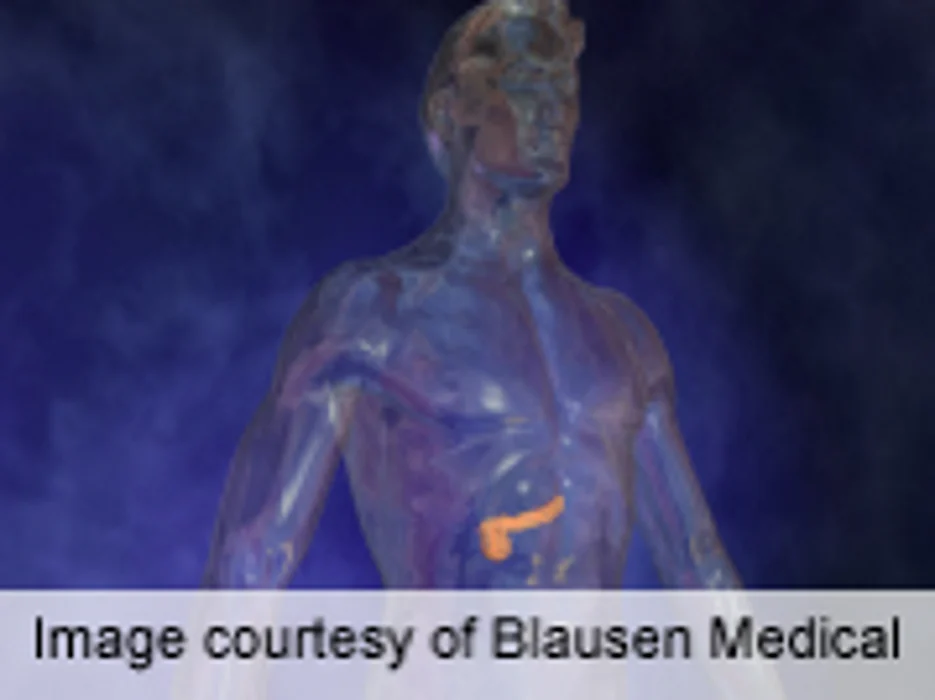 ECC: Diabetes May Lead to More Breast, Colorectal Cancer