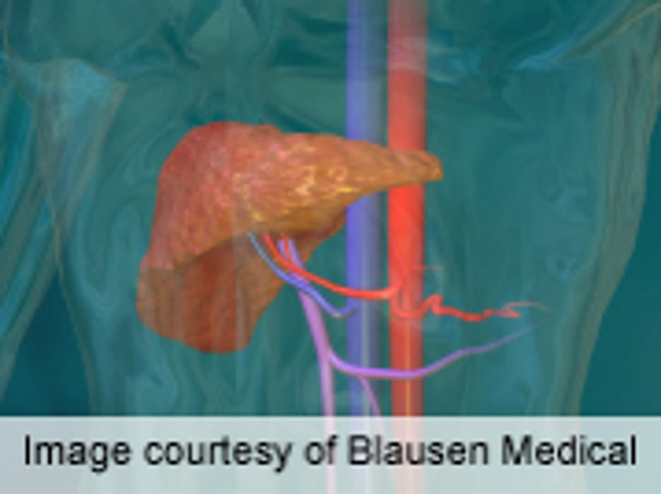Donor Obesity Ups Risk of Poor Pediatric Transplant Outcome