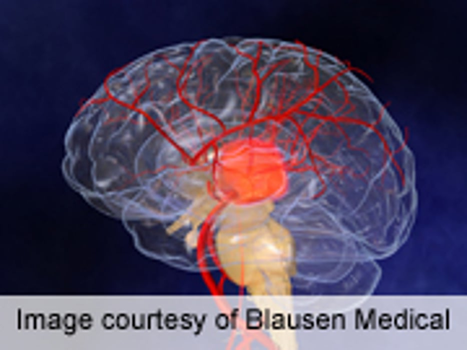 New Blood Thinner May Lower Chances of Clots in High-Risk Heart Patients: FDA