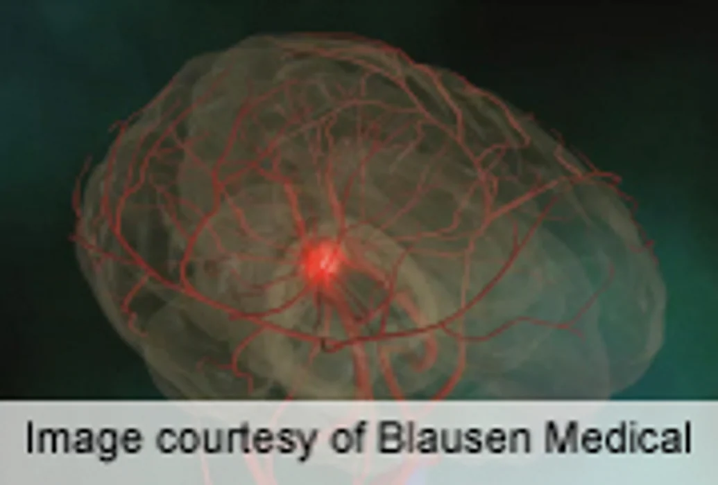 High Fiber, Fruit/Vegetable Intake Cuts Stroke Risk in T2DM