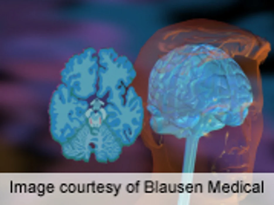 ASTRO: Two Questions Can ID Depression in Cancer Patients