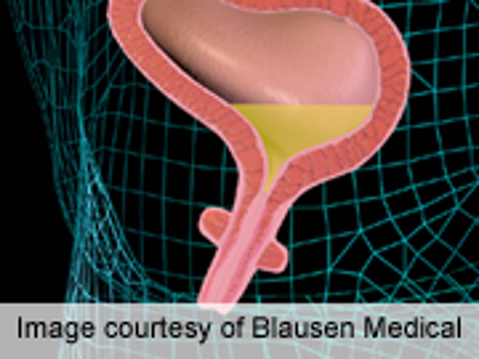 Post-Radical Cystectomy Discharge Patterns Described