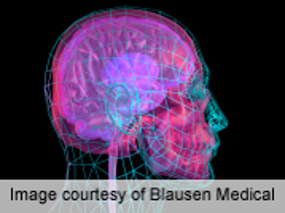 Brain Scans May One Day Be Used to Predict Dementia