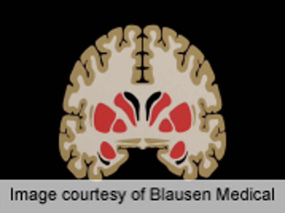 Racial Disparity in CT Use for Children With Head Trauma