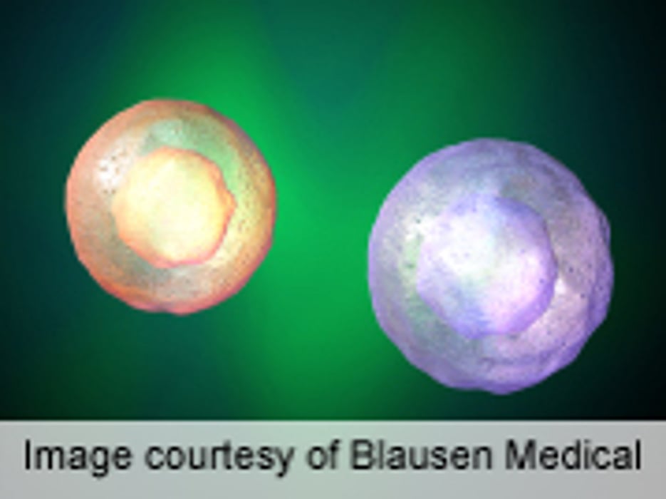 Bortezomib Beneficial in Graft-Versus-Host Disease Prophylaxis