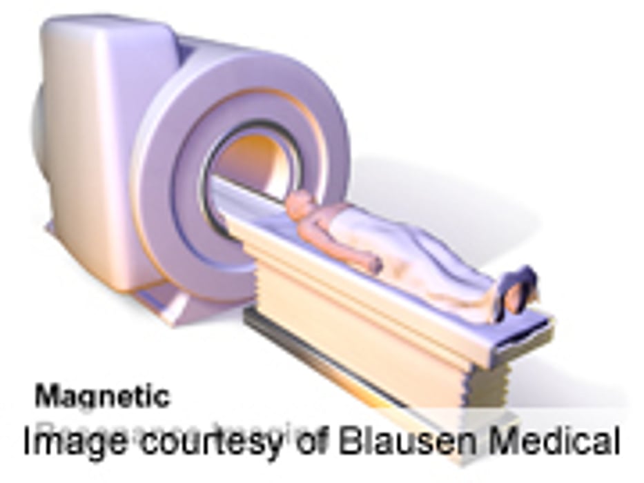 High-Field MRI Superior for Delineation of Alar Ligaments