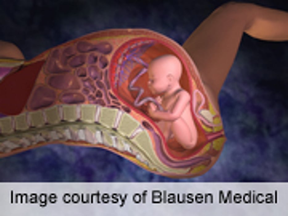 Maternal Obesity Ups Early Neonatal Mortality in Africa