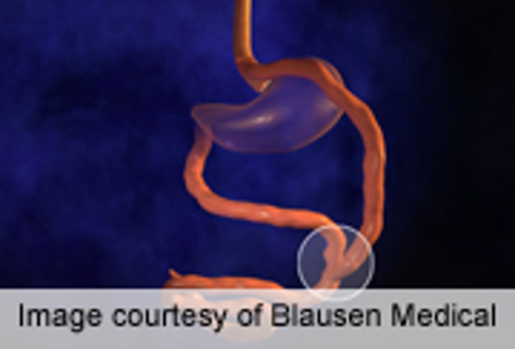 Bariatric Surgery in T1DM Teens Doesn't Aid Glycemic Control