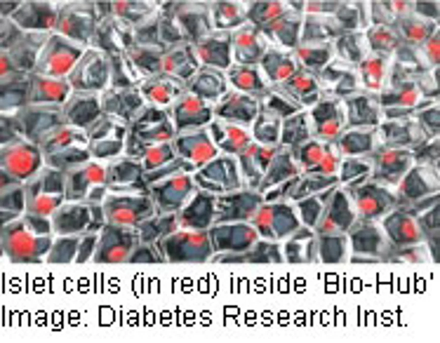 Mini-Organ Would Mimic Pancreas to Treat Type 1 Diabetes