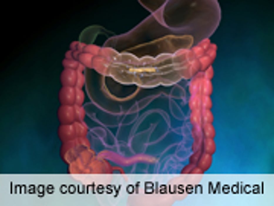 IDSA: Oral Ingestion Viable for Fecal Microbiome Transplant