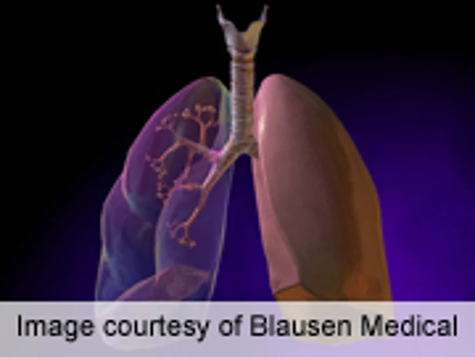 U.S. Panel Backs Routine Lung CT Scans for Older, Heavy Smokers