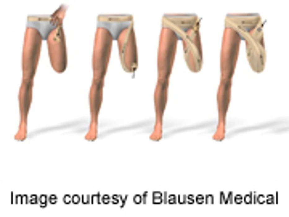 EMG Signals Can Improve Robotic Leg Prostheses Control