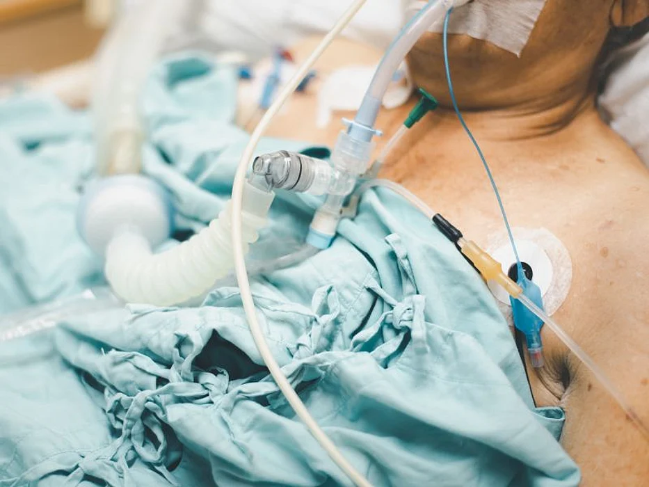 tracheotomy