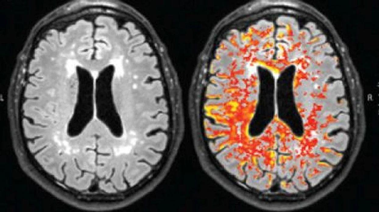 brain