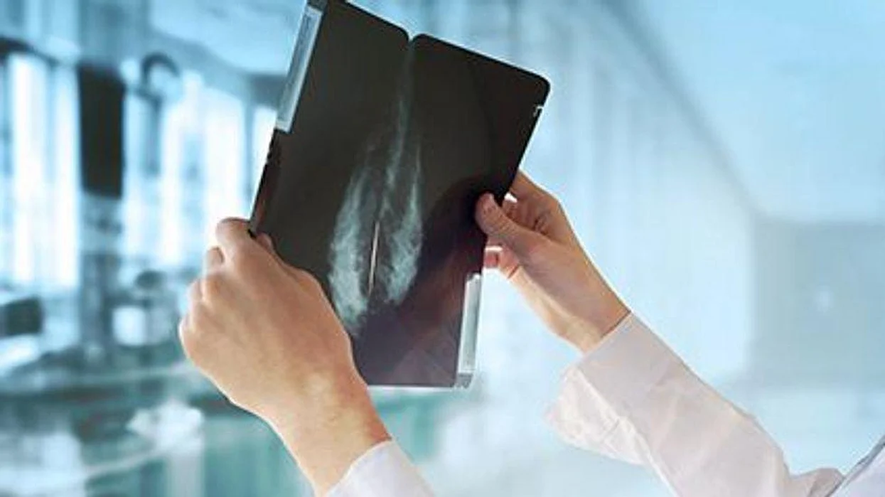 weight and breast cancer risk