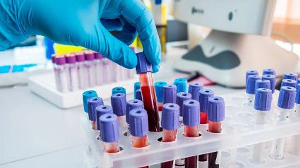blood samples