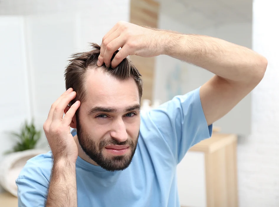 balding bald hair