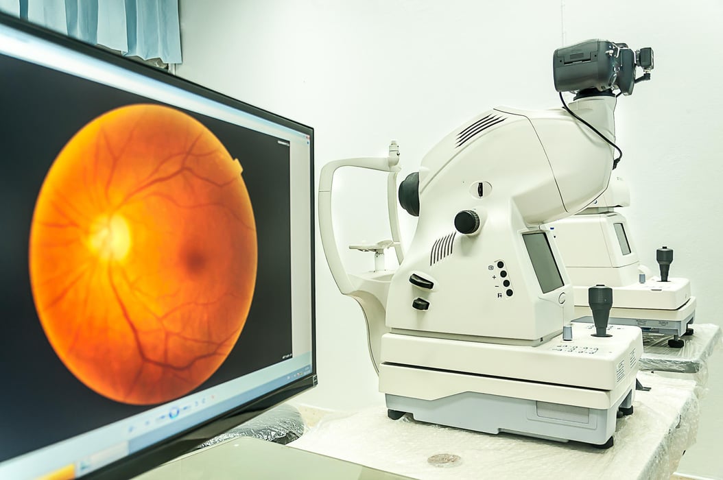 fundus camera use for  examination eye  in hospital retina