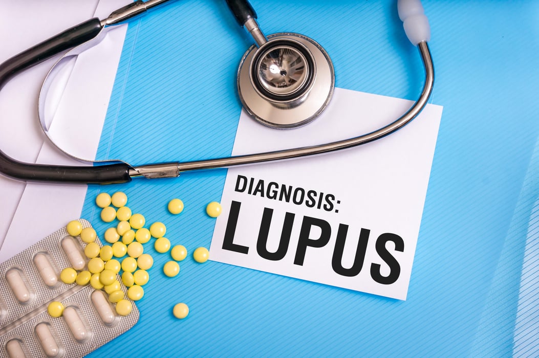 Lupus word written on medical blue folder with patient files