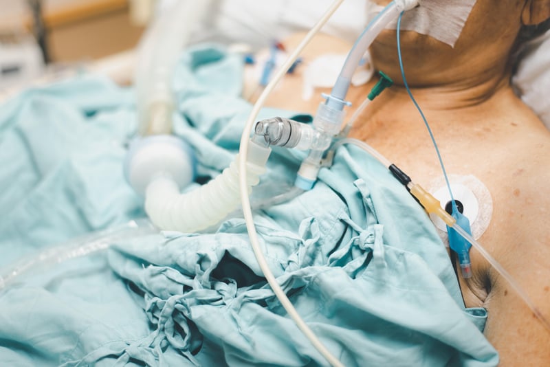 Why Patients on Ventilators May Take Weeks to Regain Consciousness