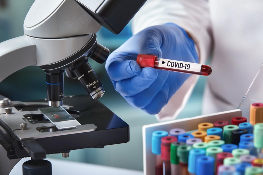 microbiologist with a tube of blood analyzed under a microscope and contaminated by Coronavirus with label covid-19