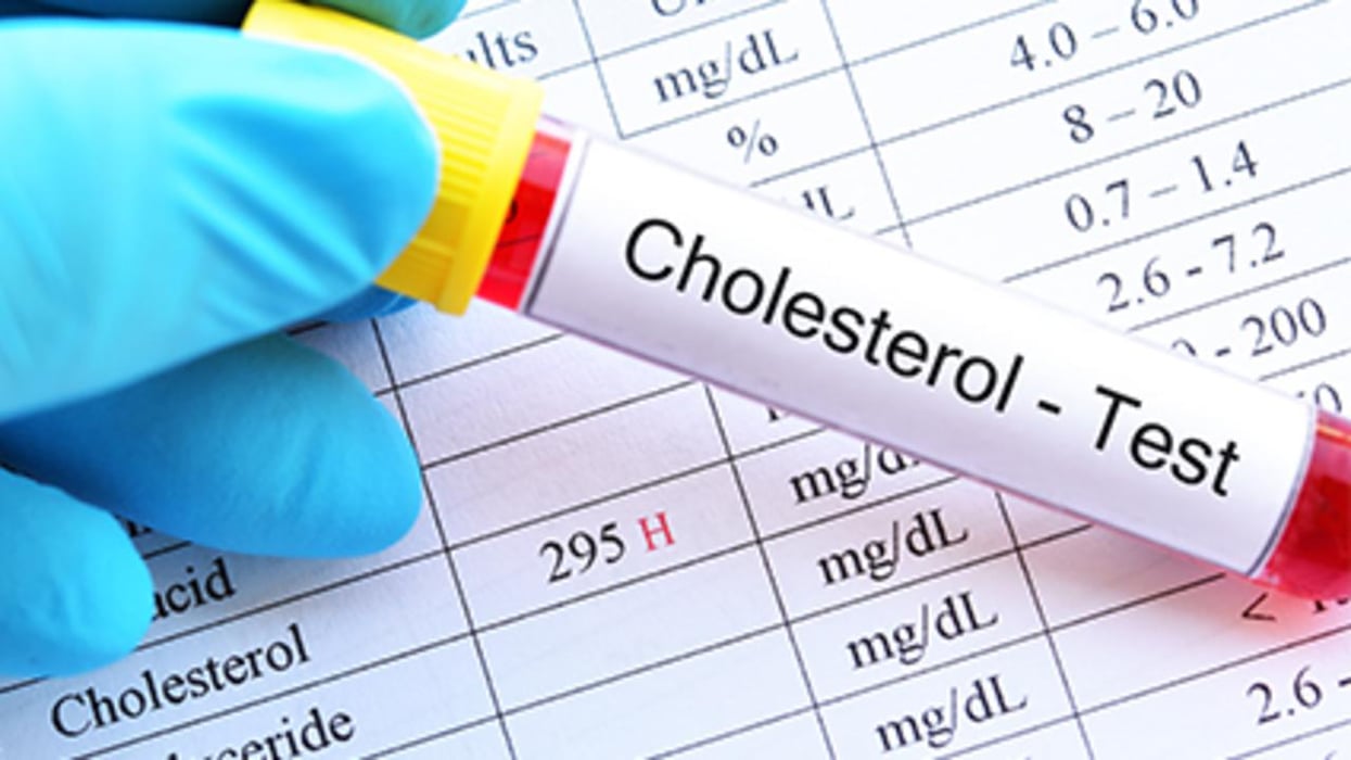 High Cholesterol In Your 30s Could Raise Future Alzheimer’s Risk, Study Finds