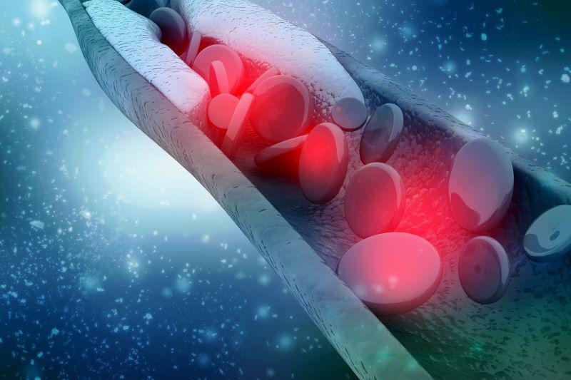 Blood Clot Risk Remains Higher Almost a Year After COVID