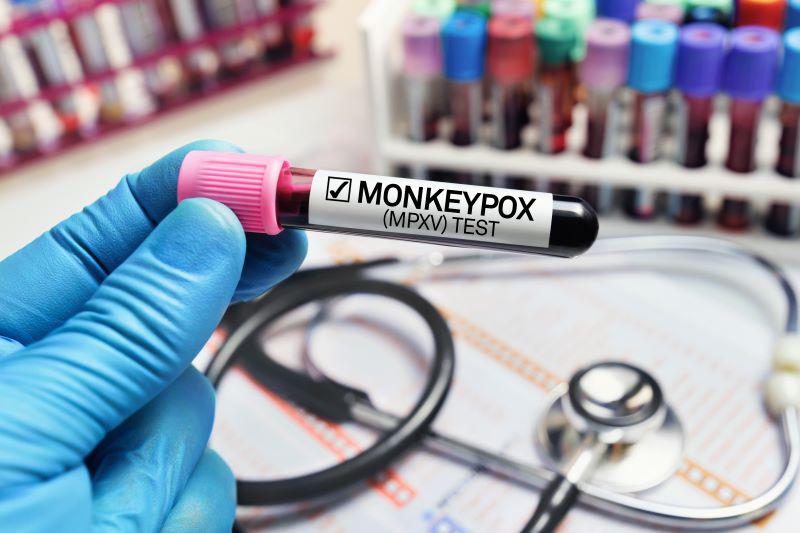 新闻图片:美国第二个人在猴痘诊断后死亡