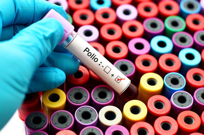New York Declares Emergency Due to Poliovirus