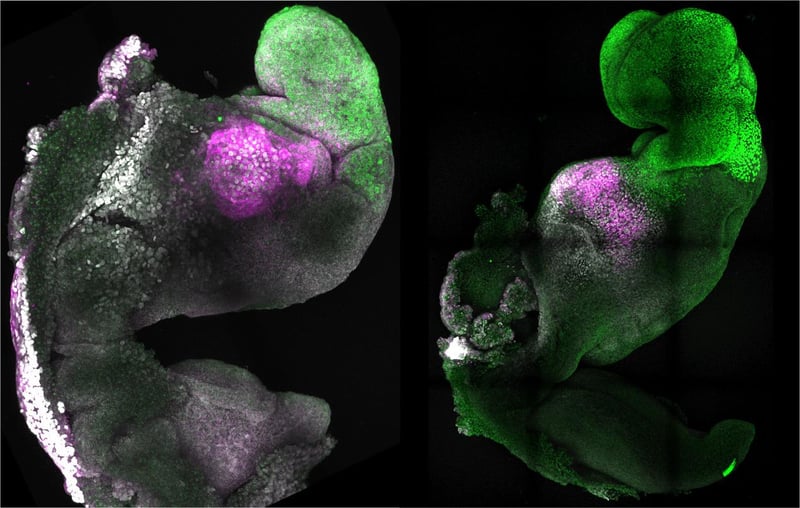 News Picture: Scientists Create Synthetic Mouse Embryo With Brain, Beating Heart