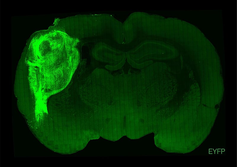 Scientists Transplant Human Brain Cells Into Rat Brains, a Boon to Research