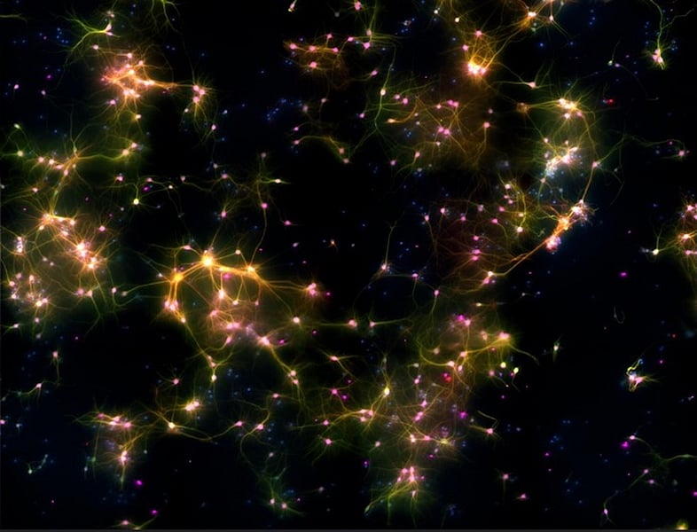 Group of Brain Cells in Dish Can Play Computer Game Pong