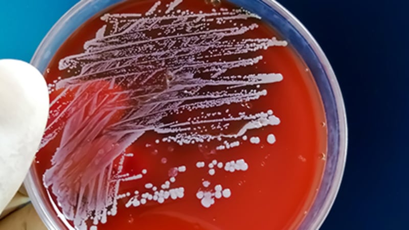 Trouble-Making Bacteria Like These 3 Skin Regions Best