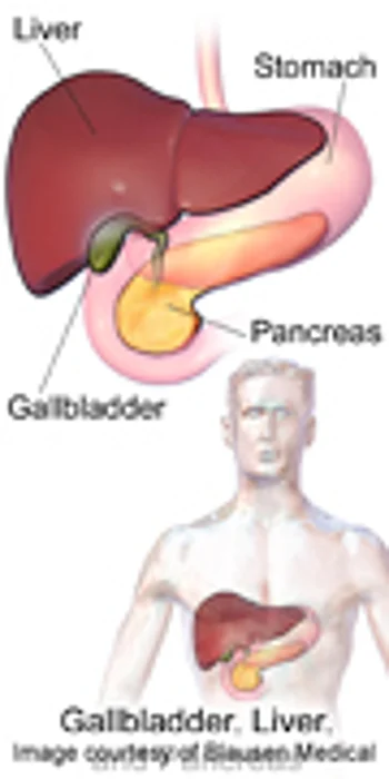 Obese Patients With Pancreatic Cancer Have Shorter Survival, Study Finds