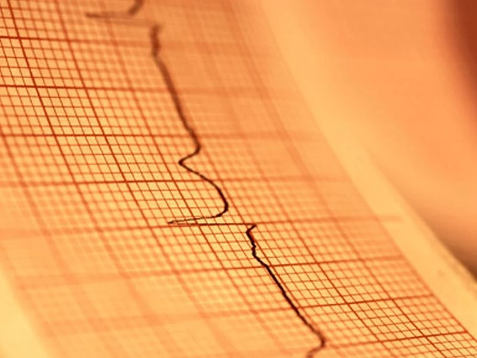 1 in 4 Adults Has Liver Disorder That Ups Heart Risks