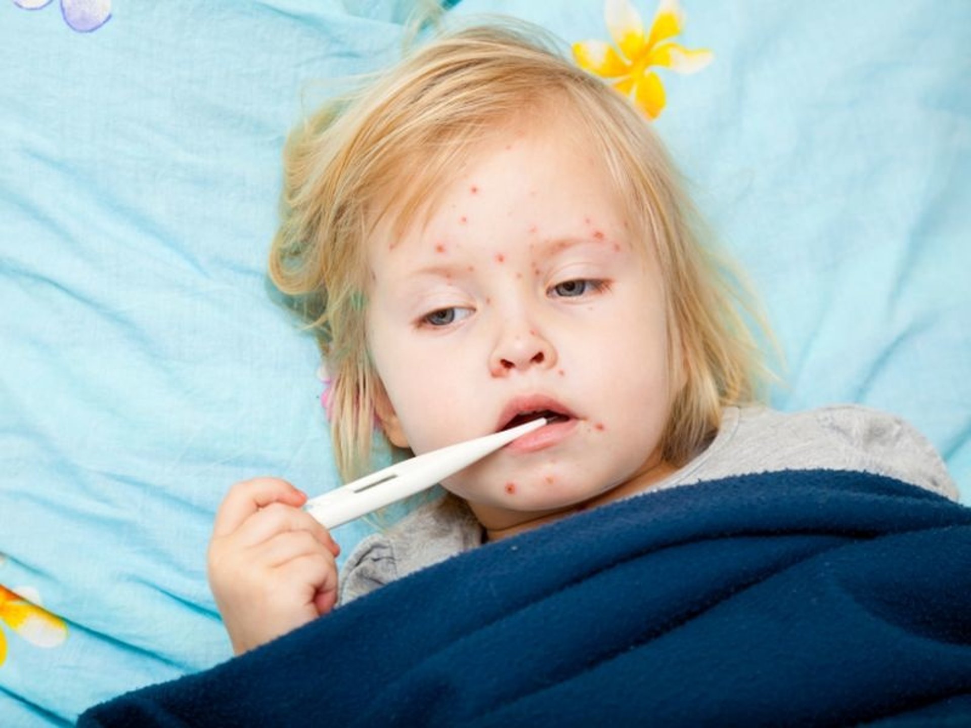 News Picture: Driven by Anti-Vaxxers, Measles Outbreaks Cost Everyone Money