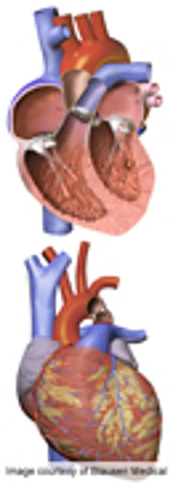 Could Flu Raise Risk of Fatal Artery Tear?