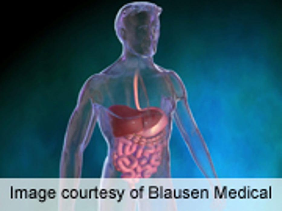 DDW: Electroacupuncture Useful for Endoscopic Ultrasound
