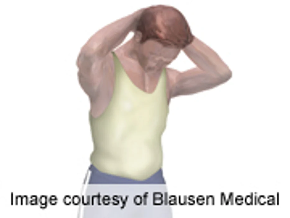 Researchers ID Gene for Neck Disorder