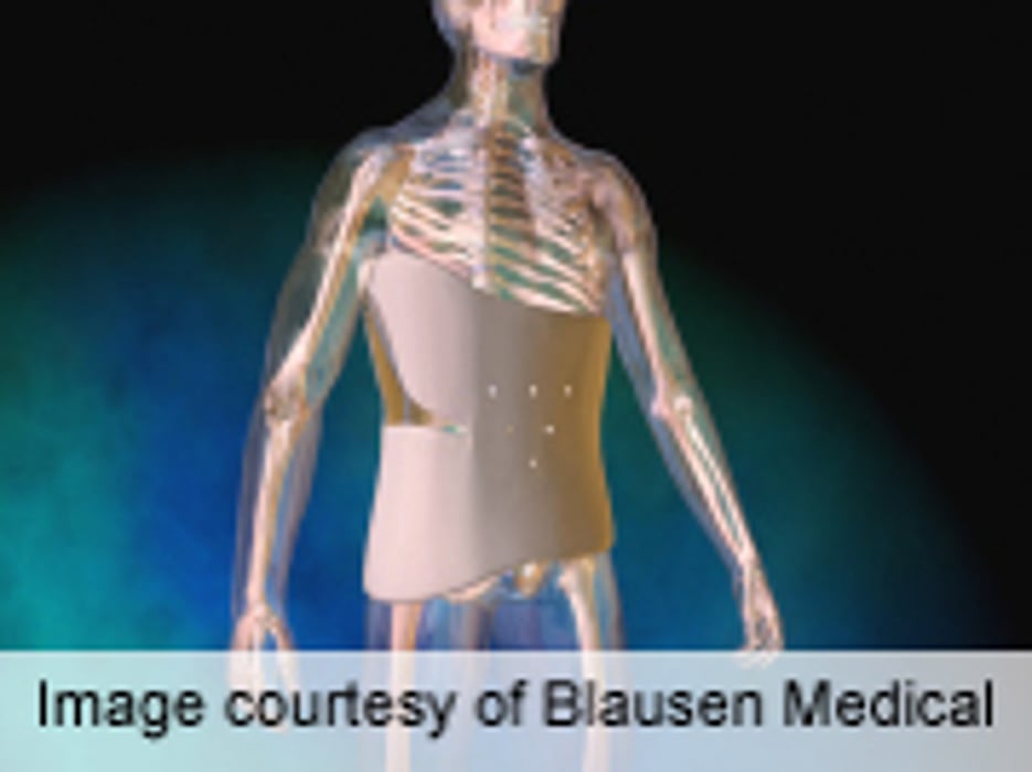 Child's Scoliosis Stresses Patients, Parents: Study