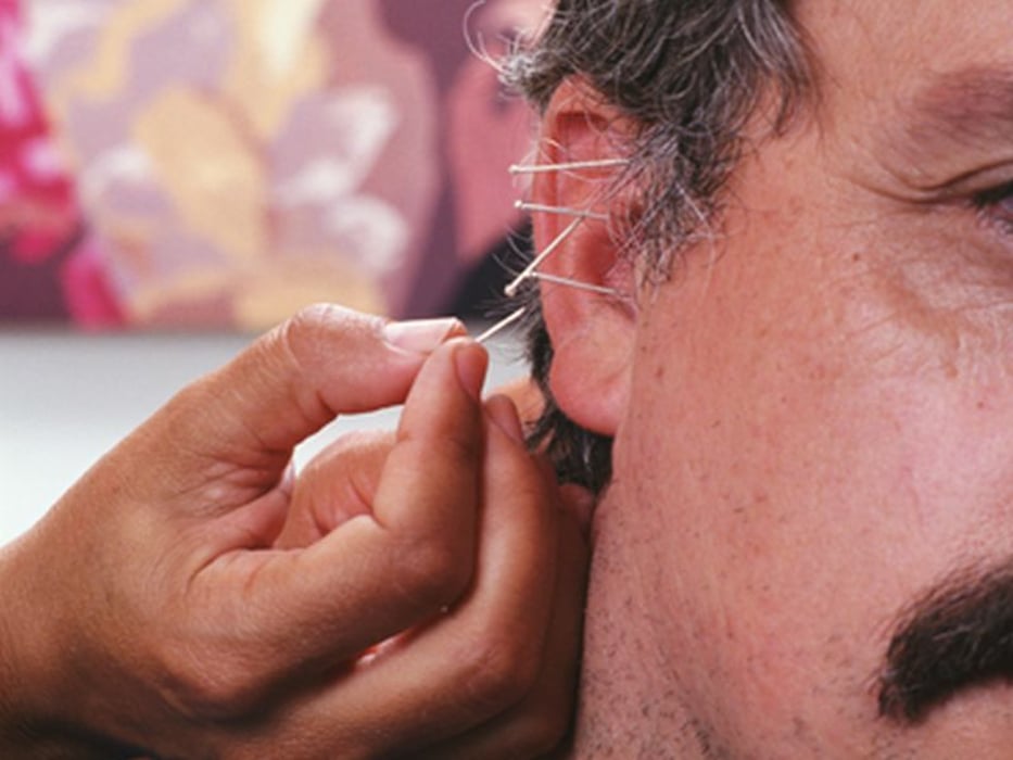 acupuncture on ear