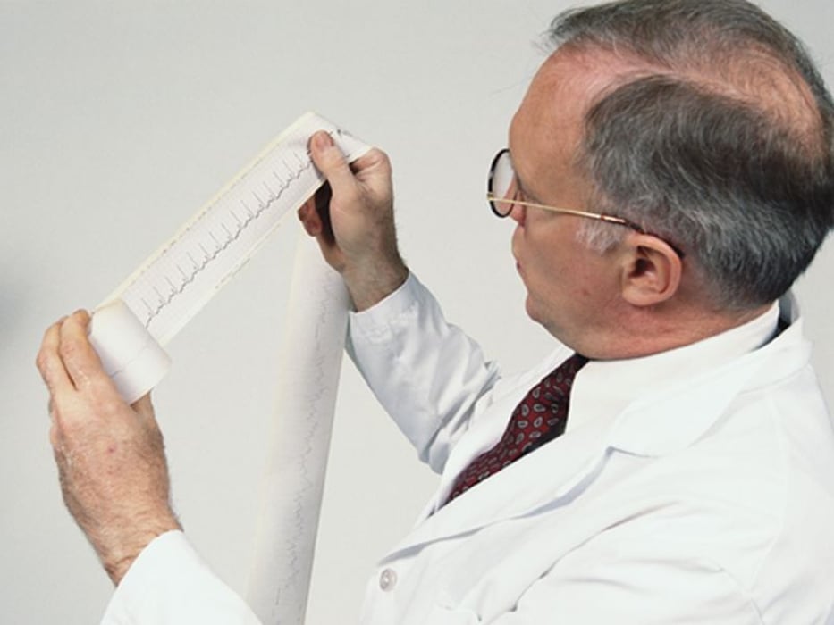 a doctor reading a ekg scan