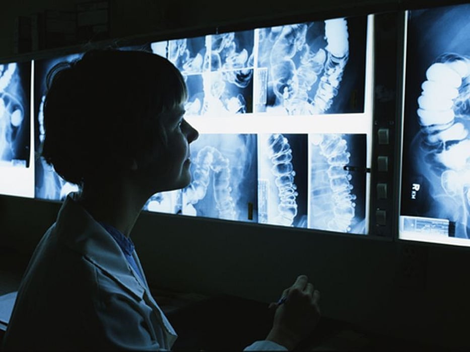 xray pictures