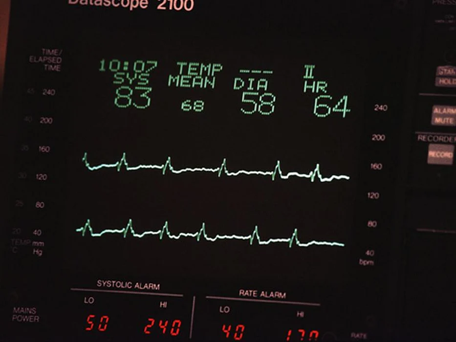 heart monitor